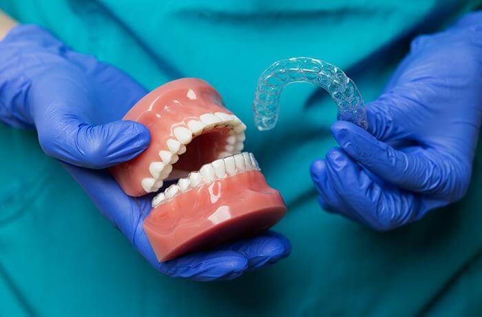 How Much Does Invisalign Cost in Australia?